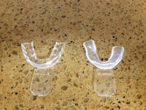 Teeth Molds After, Smile Sciences